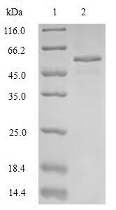 Human SFTPB protein