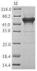 Human SSB protein