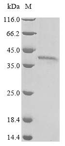 Human WNT7B protein