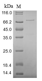 Human XRCC5 protein