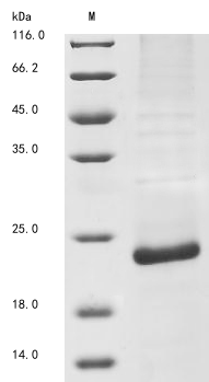 Virus Haplopelma schmidti Tau-theraphotoxin-Hs1a protein