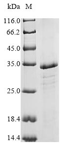 Virus Odorant-binding protein protein