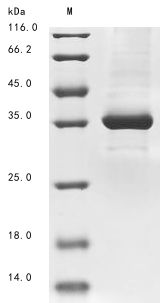 Virus GP protein