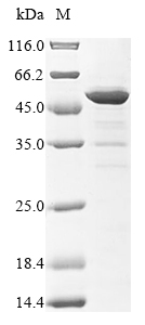 Virus Vesicular stomatitis Indiana virus Nucleoprotein(N) protein