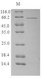 Virus Odorant-binding protein protein