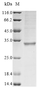 Virus GPC protein