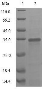 Virus A Outer capsid glycoprotein VP7 protein