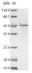 Human RIPK1 protein