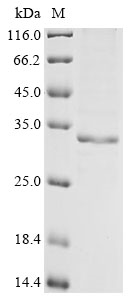 Rat Hsd17b13 protein