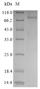 Mouse Ripk1 protein