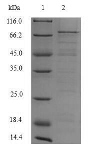 Virus ORF2 protein