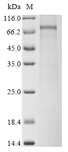 Human SARM1 protein