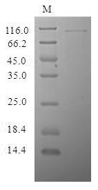 Human CRISPLD2 protein