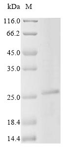 Mouse Tnni1 protein