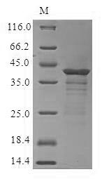 Human CCR6 protein