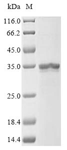 Human DGAT1 protein