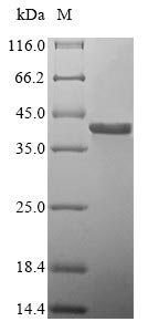 Human GP1BB protein