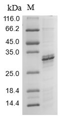 Human SLC5A2 protein