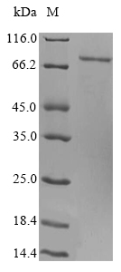 Human SLFN12 protein