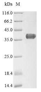 Human AGTRAP protein