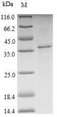 Porcine TSPO protein