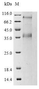 Human ZNT8 protein