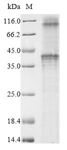 Primate GNRHR2 protein