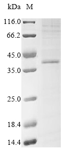 Human P2RY12 protein