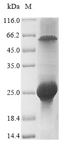 Virus Gorilla gorilla gorilla Fibroblast growth factor protein
