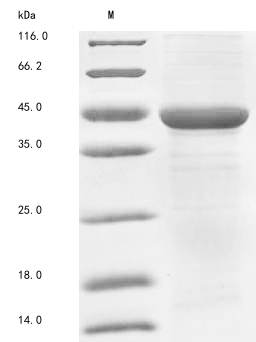 Human ACAT1 protein