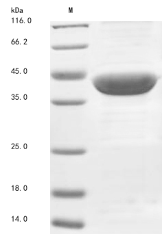 Human ACAT1 protein