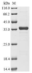 Human ADAR protein