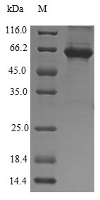 Human ALAS2 protein