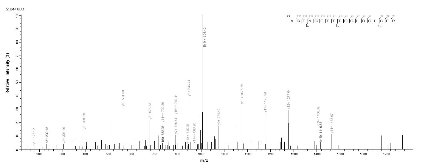 Human ALDOA protein