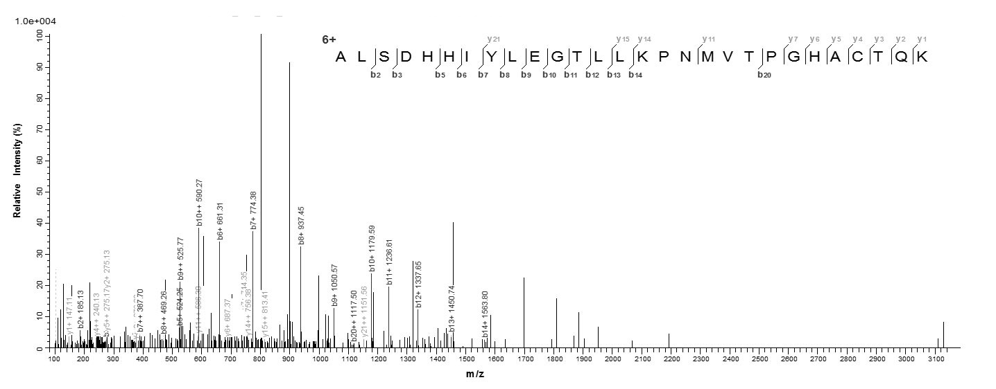 Human ALDOA protein