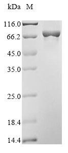 Human ALOX12 protein