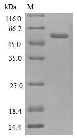 Human ANXA2 protein