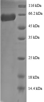Human ANXA2 protein