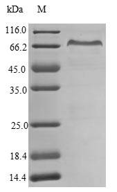 Human AOC2 protein