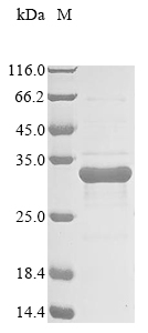 Human APOB protein