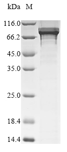 Human BCL6 protein