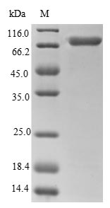 Human CALR protein