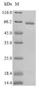 Human CBS protein