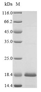 Human CD3E protein