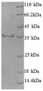 Human CDK4 protein