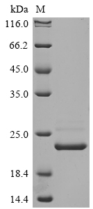 Human CRYAB protein
