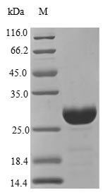 Human CTSS protein