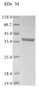 Human CXCR3 protein