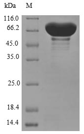Human CYP11B1 protein