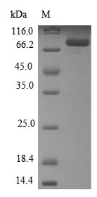 Human CYP21A2 protein